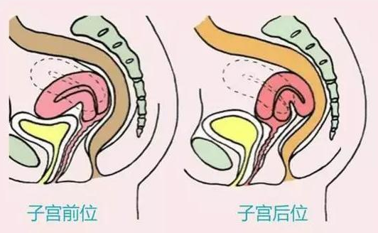 子宫后位与子宫前位的位置区别图