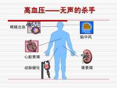 高血压是什么有几种？高血压有哪些症状表现及如何治疗