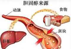 胆固醇高的原因危害,吃什么食物降下来有什么症状