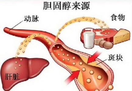 胆固醇来源