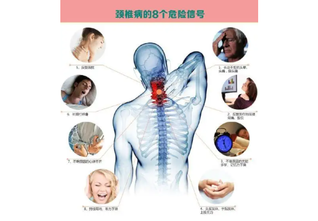颈椎病容易导致背痛、头晕、上肢和头皮发麻